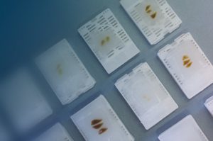 Webinar-Bringing Precision Medicine to Cancer Immunotherapy_Blog Thumbnail